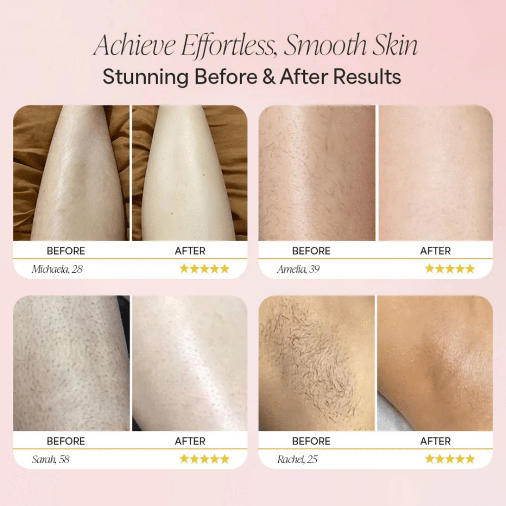 Dermave Trimmer 2.0 (Official Retailer) 2025